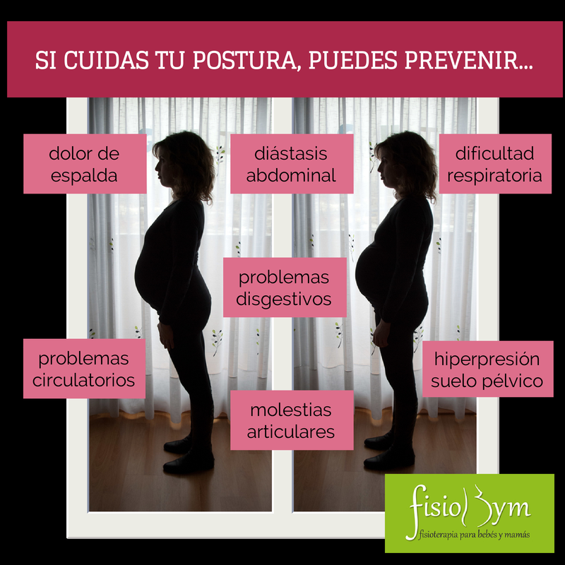 Diastasis Abdominal En El Embarazo Importancia De La Postura